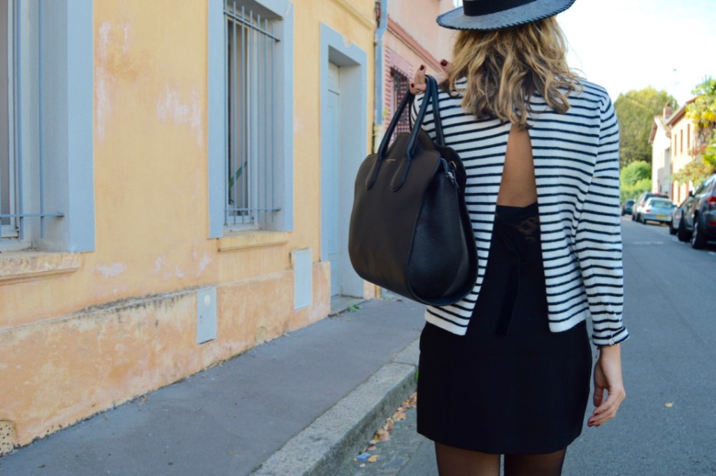 ~ Le cas des&nbsp;cuissardes.